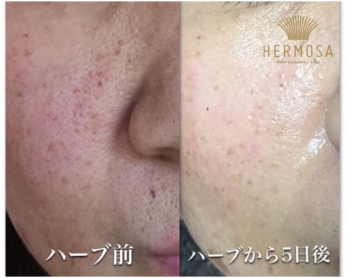 C8C54619-18C3-4EB4-9E95-E3D248B851DE