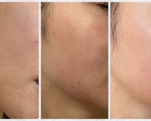 B4FA0F2E-2511-4862-8D7B-30D9C7411BA1